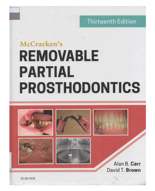 McCracken's REMOVABLE PARTIAL PROSTHODONTICS Thirteenth Edition