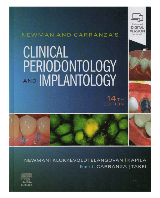 Newman and Carranza's Clinical Periodontology and Implantology 14th Edition